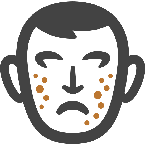 여드름 후유증으로 남은 홍반&amp;#44; 효과적인 관리법은?