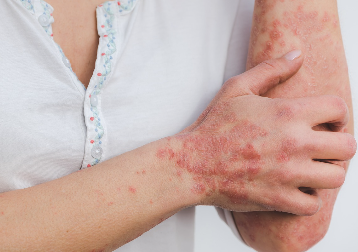 피부가려움증의 원인