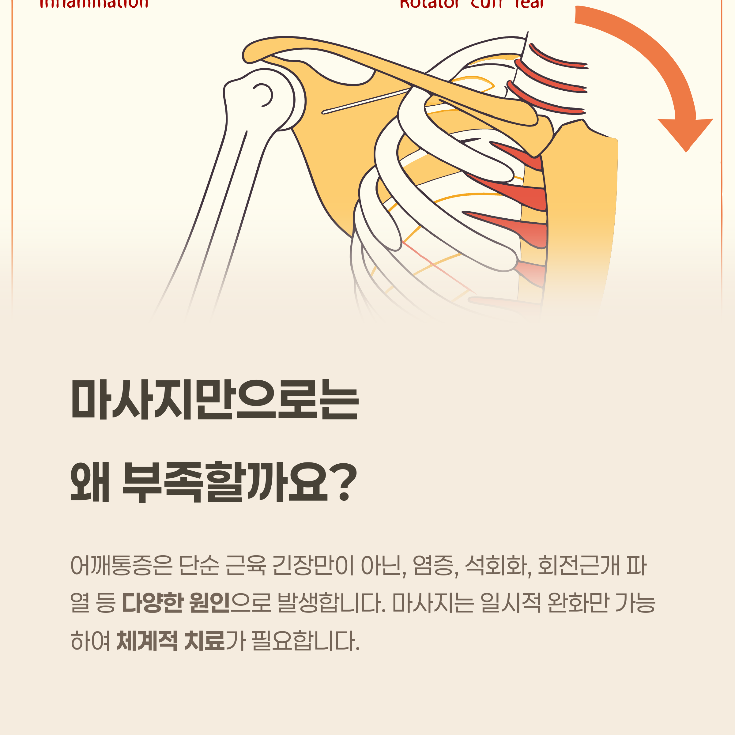 어깨통증, 왜 마사지만으로는 부족할까요?
