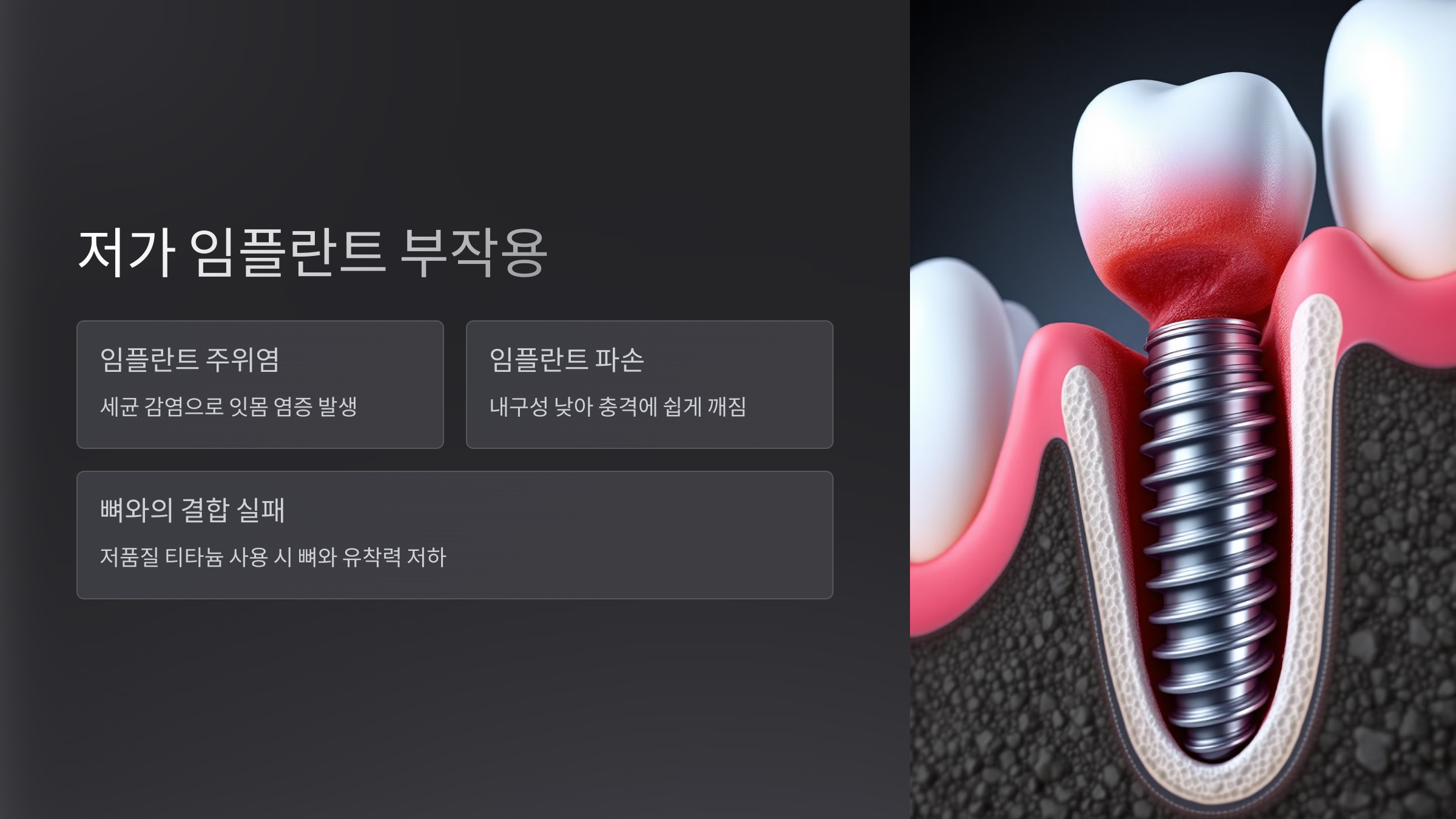 저가 임플란트 부작용