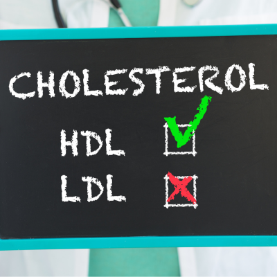 고밀도 지질단백질 HDL