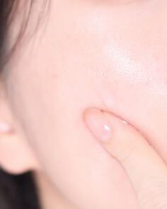 탱글탱글한-피부에-언제부터인가-왼쪽-볼에-기미가-생기기-시작한-여성