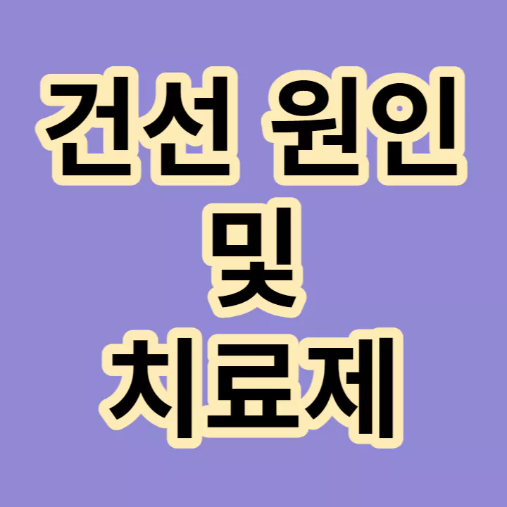 건선-원인-치료제-썸네일