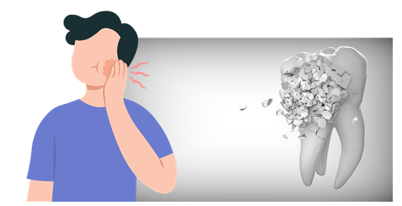 충치 초기 증상