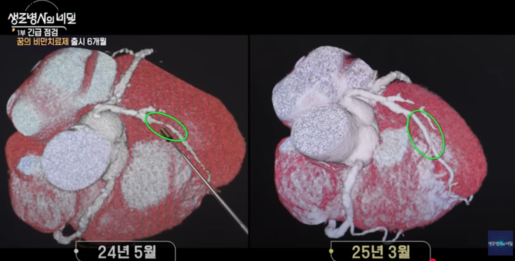 생로병사의 비밀