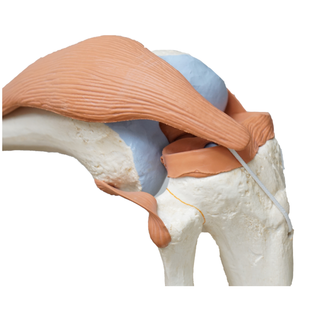 류마티스 관절염과 관련된 사진입니다.