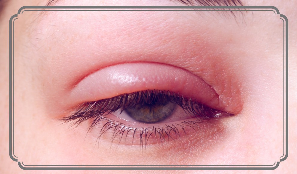 염증에 좋은 음식