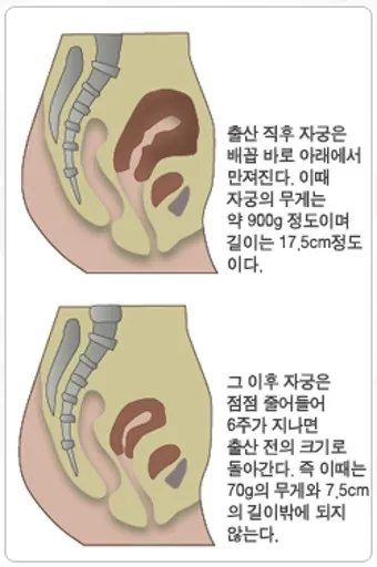 출산 후 자궁수축 기간_3