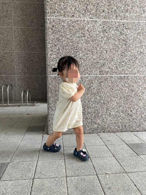 아기 머리 땀
