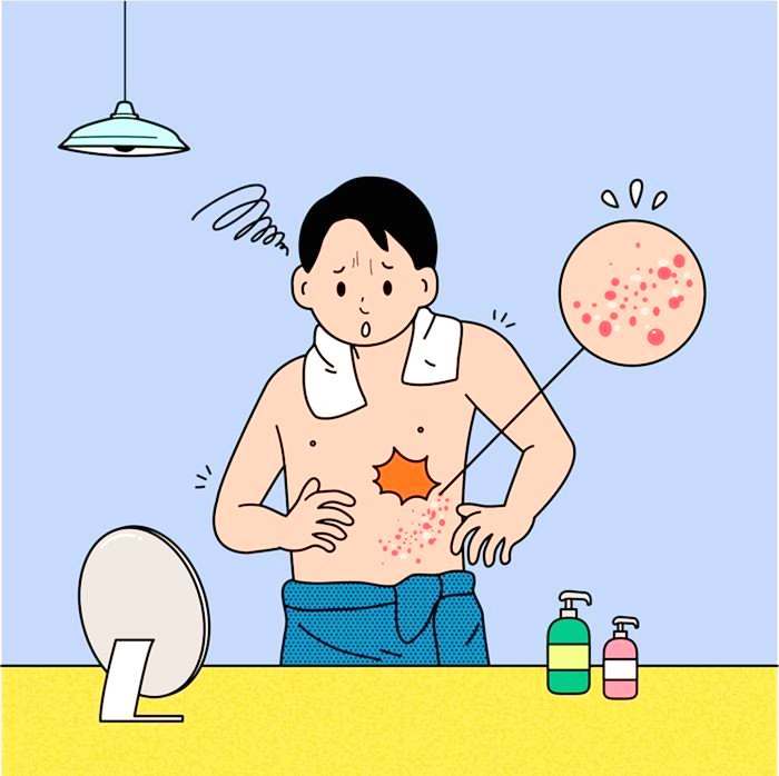 생로병사의 비밀 857회 여성 발생 더 높은 대상포진 예방 접종 무료 가격 치료 후유증 관리 방법