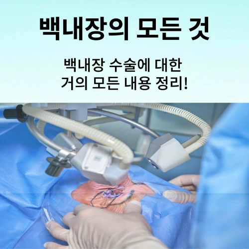 백내장 수술의 과정, 비용, 인공수정체 종류, 부작용, 회복 기간, 안경을 써야 하는 이유까지 거의 모든 내용을 정리한 글. 사진은 백내장 수술 과정이다.