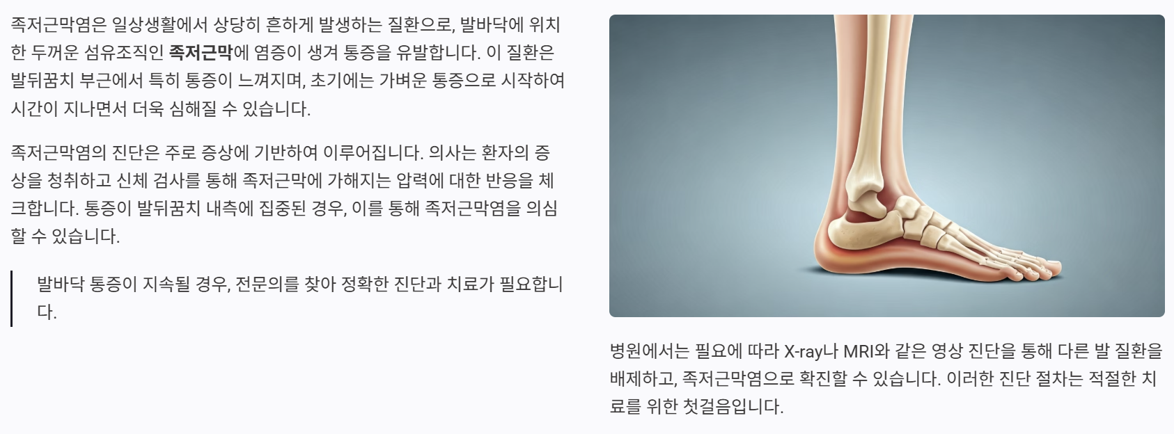 족저근막염의 정의와 이해