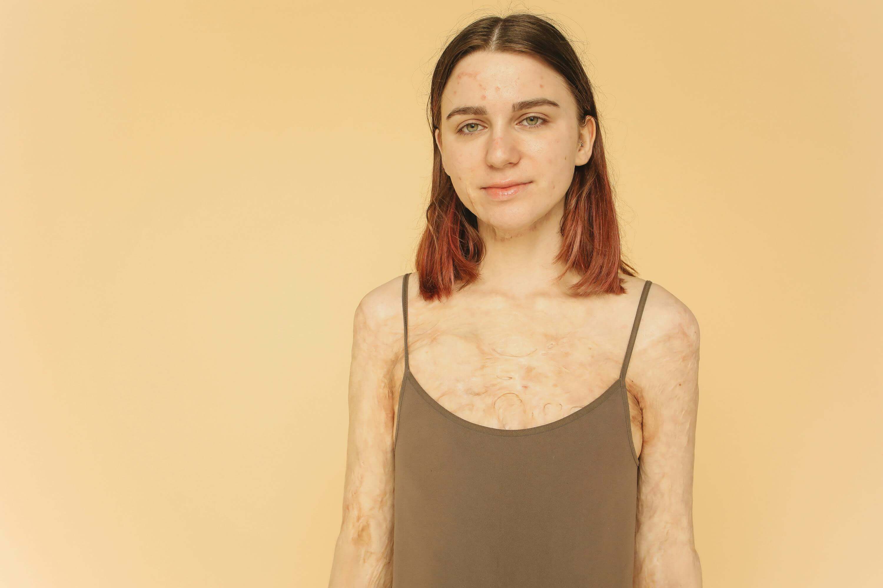 환절기 트러블 예방법 총정리 피부 뒤집어지기 전에 꼭 확인하세요