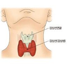 갑상선 기능 저하증의 증상과 7가지