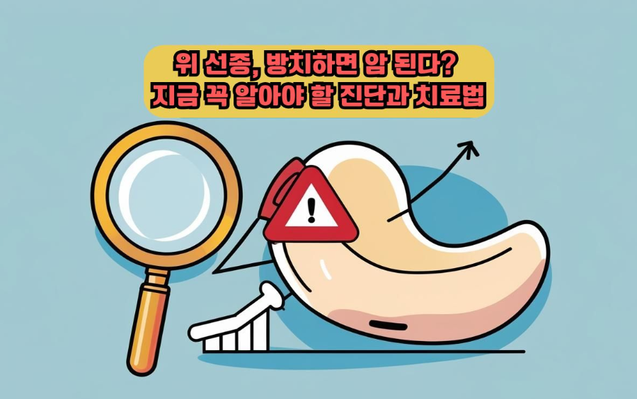 위 선종, 방치하면 암 된다? 지금 꼭 알아야 할 진단과 치료법