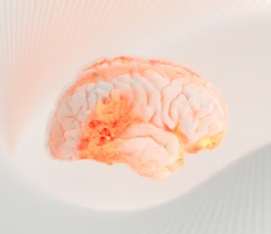 섬유근육통 초기증상 원인 치료법