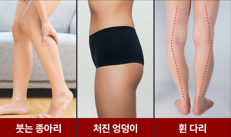 바르너 아치스본 효과