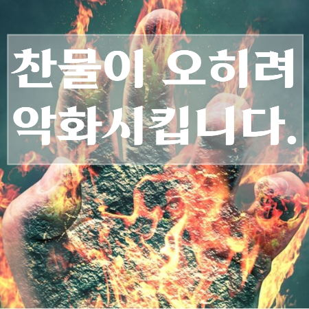 화상-응급처치법