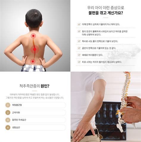 척추측만증 교정운동