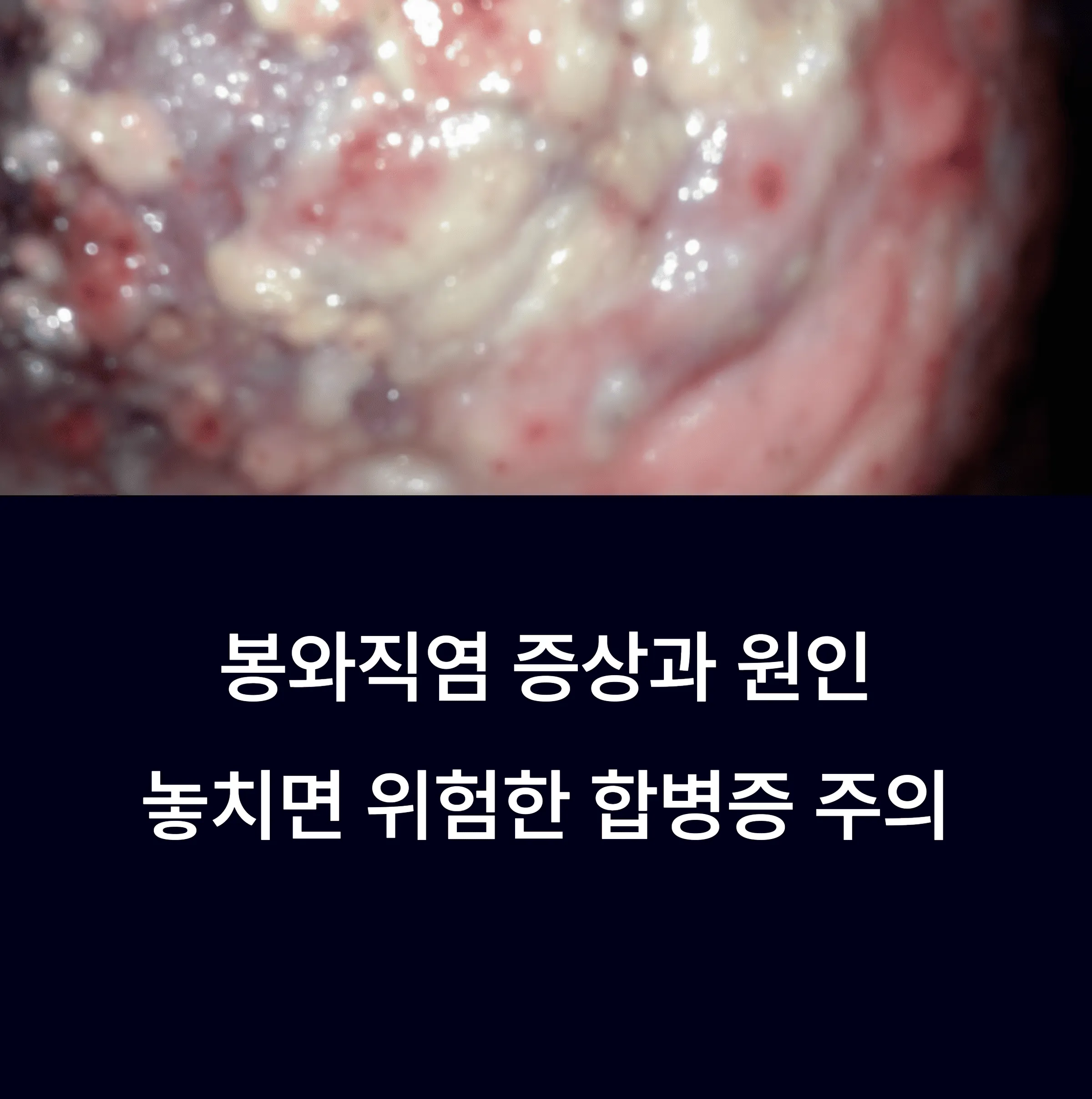 봉와직염 증상과 원인, 놓치면 위험한 합병증 주의