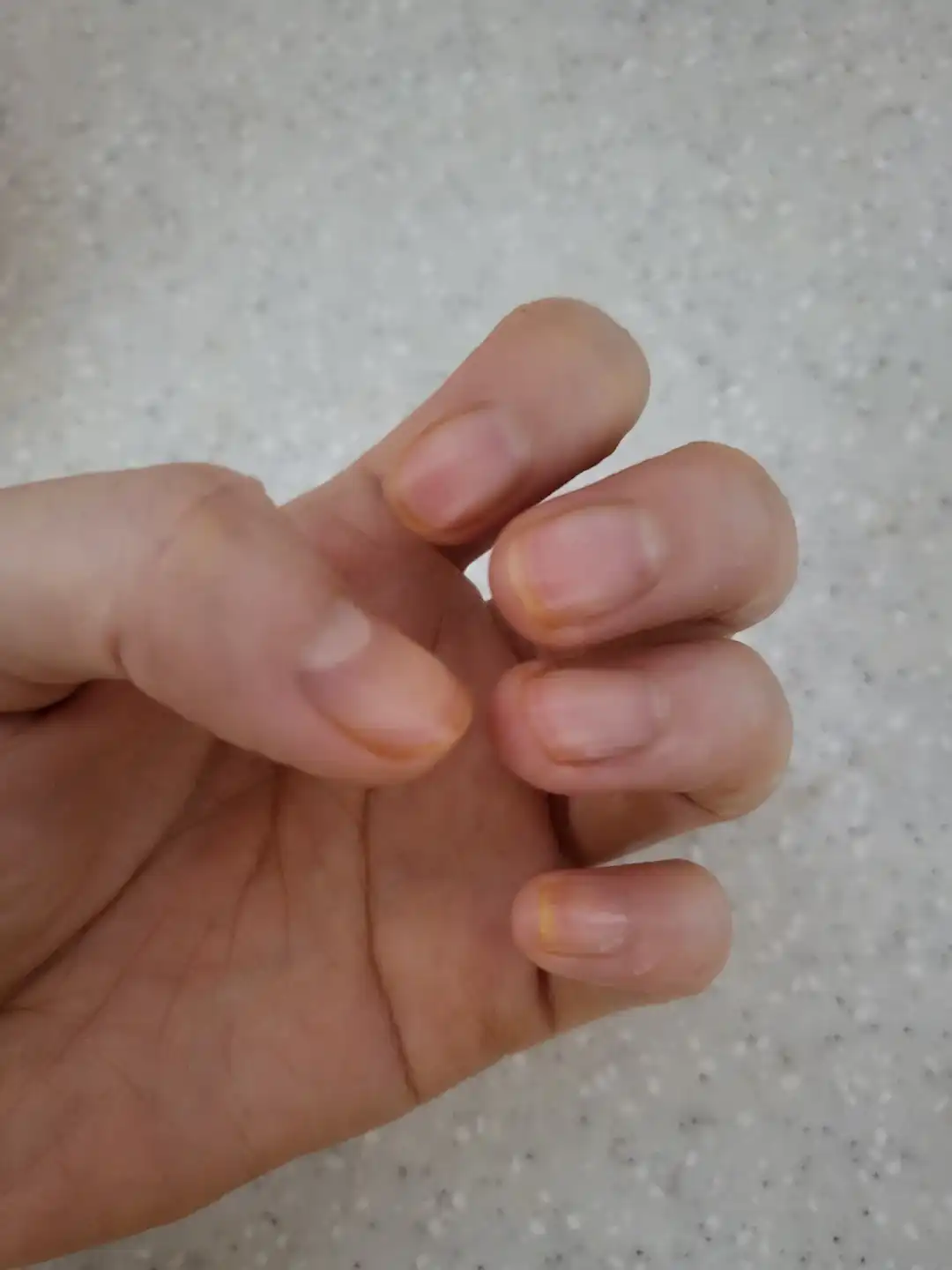 손톱이_노랗게_된_건_안비밀