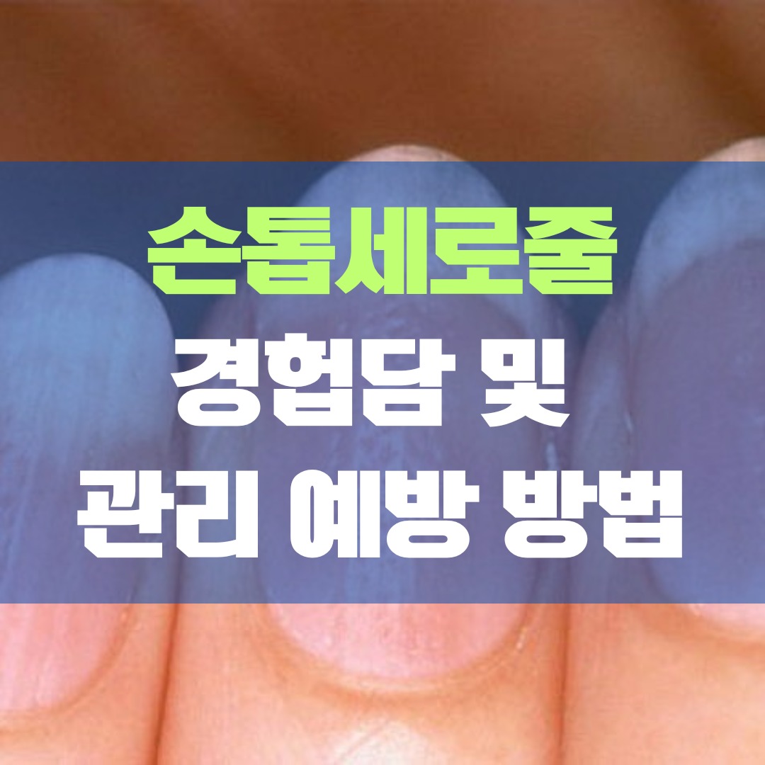 손톱 세로줄 경험담, 원인, 대처법, 관리방법
