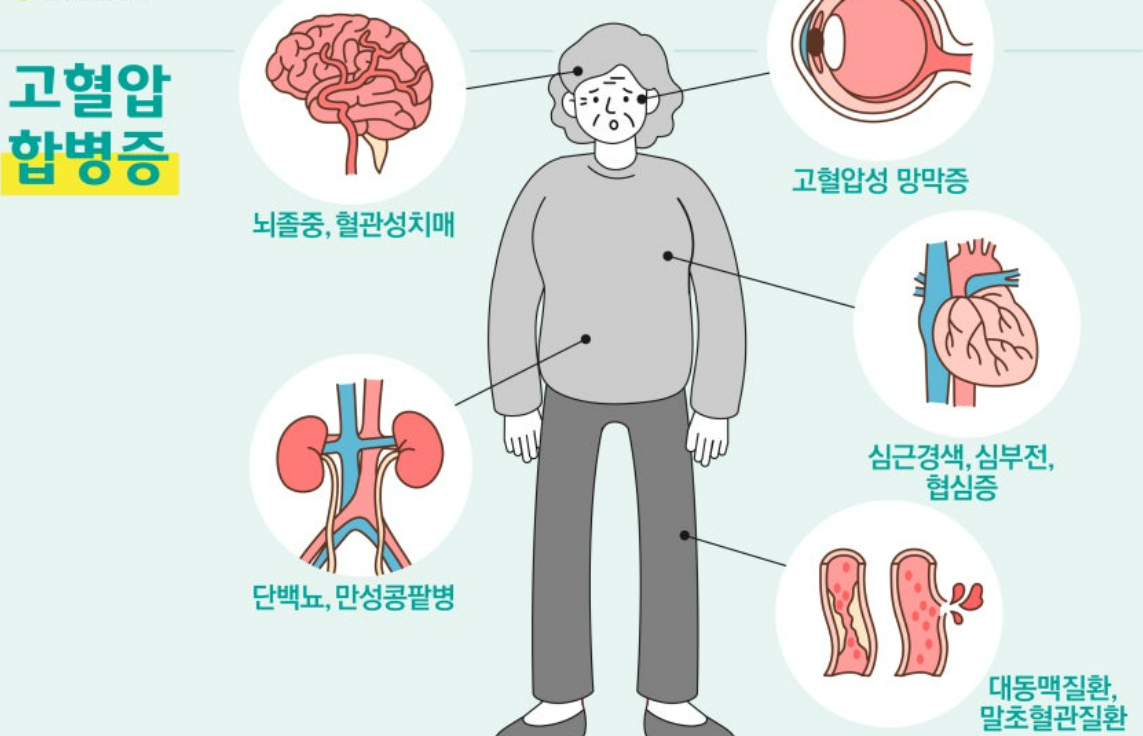 고혈압 합병증에 관한 설명