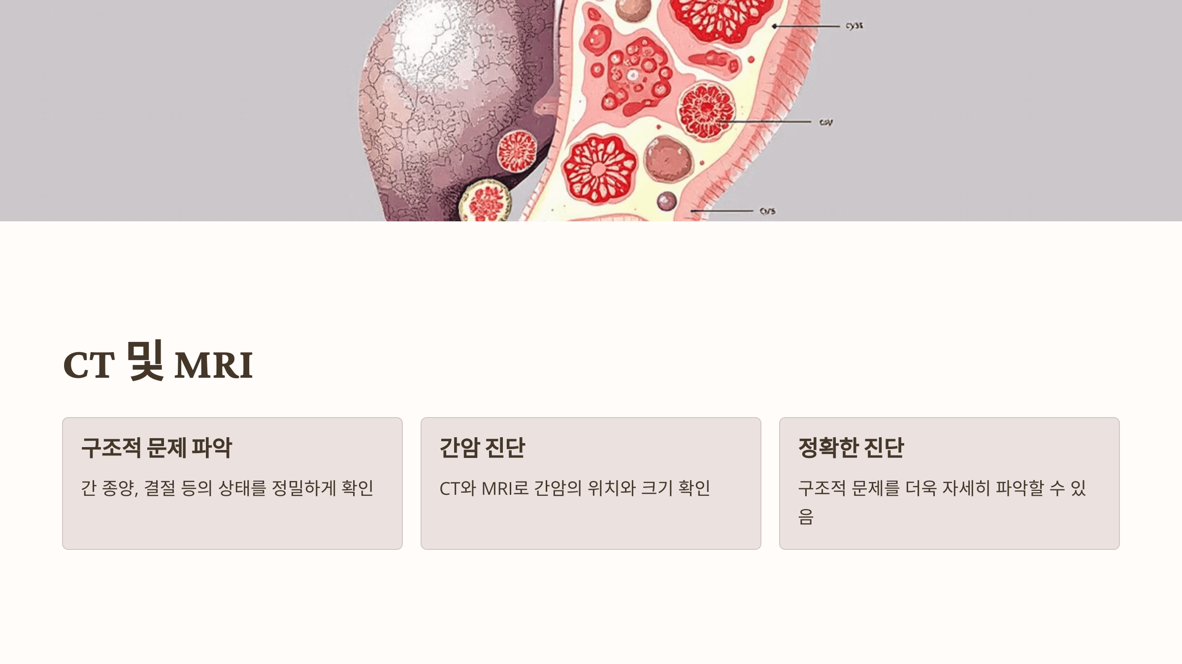 간수치와 관련된 사진입니다.