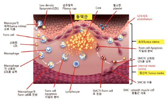 고지혈증 수치 기준, 정상이라고 안심하면 위험한 이유