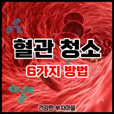 혈관 청소